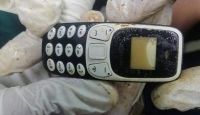 هاتف «يعيش» داخل معدة مصري لمدة عامين