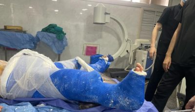 جراحة دقيقة بالساق.. فريق طبي ينهي معاناة صبي بأسيوط